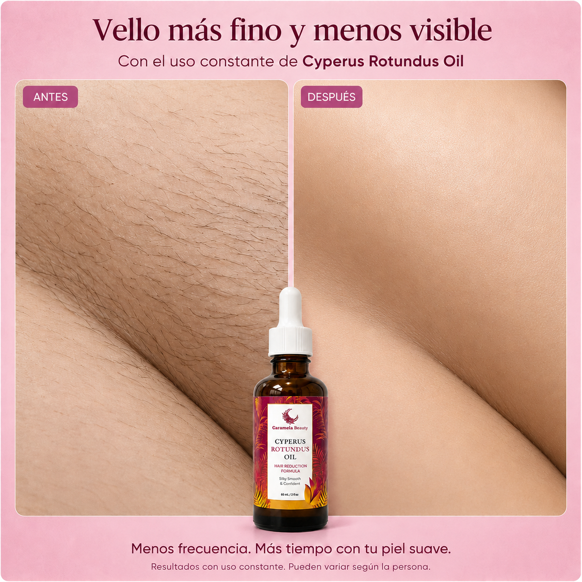 Aceite Anti-Vello Cyperus Rotundus®